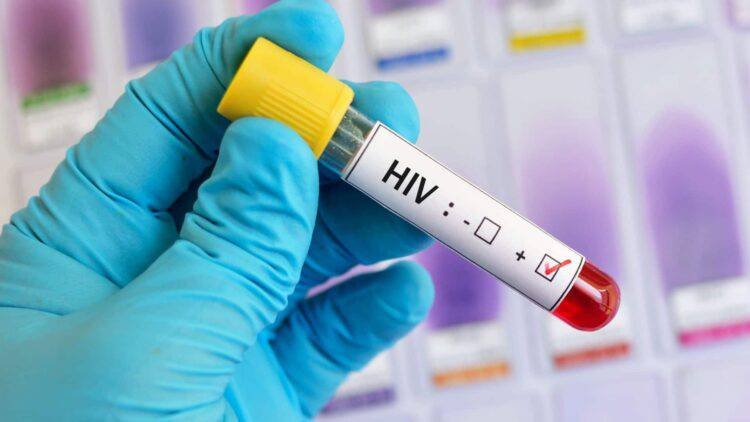 New Advances Towards Effective HIV Vaccine