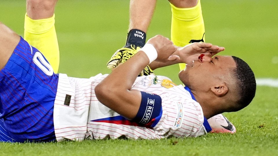 Mbappé Is Really Going to Have Surgery... But Not Just Yet