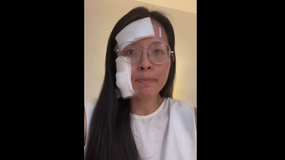 Woman Assaulted With Umbrella In Random Attack In The U.S.