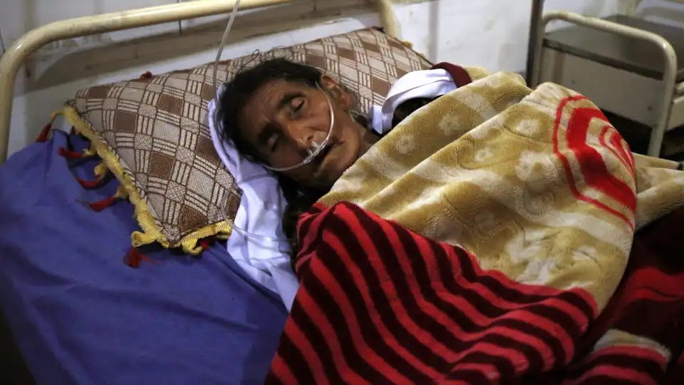 Tuberculosis Kills 1.2 Million People in 2023 and Surpasses Covid-19