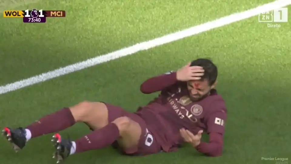 Bernardo Silva's Forehead Bleeds After Being Hit by Foden