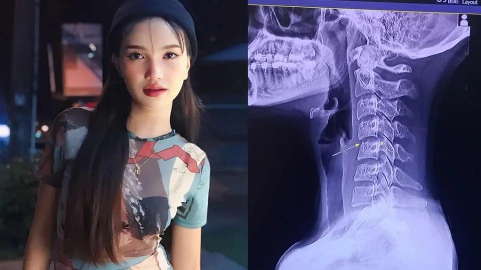 Woman Seeks Massage to Relieve Neck Pain, Ends Up Dying