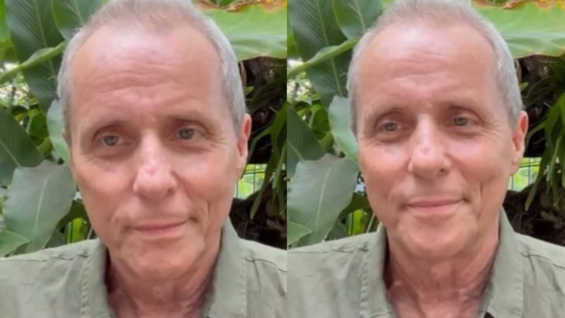 Tony Bellotto, Do Titãs, Revela Diagnóstico De Câncer No Pâncreas