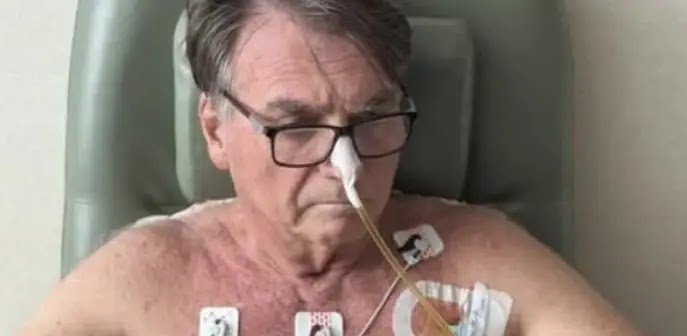 Bolsonaro Completa Quatro Dias na UTI Após Cirurgia Abdominal e Não Tem Previsão de Alta