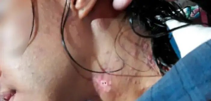 Mulher É Torturada E Tem Dentes Arrancados Com Pedra Durante Cárcere Privado