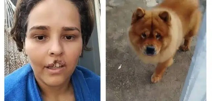 Cachorro que Mordeu e Arrancou Lábio de Tutora é Submetido à Eutanásia