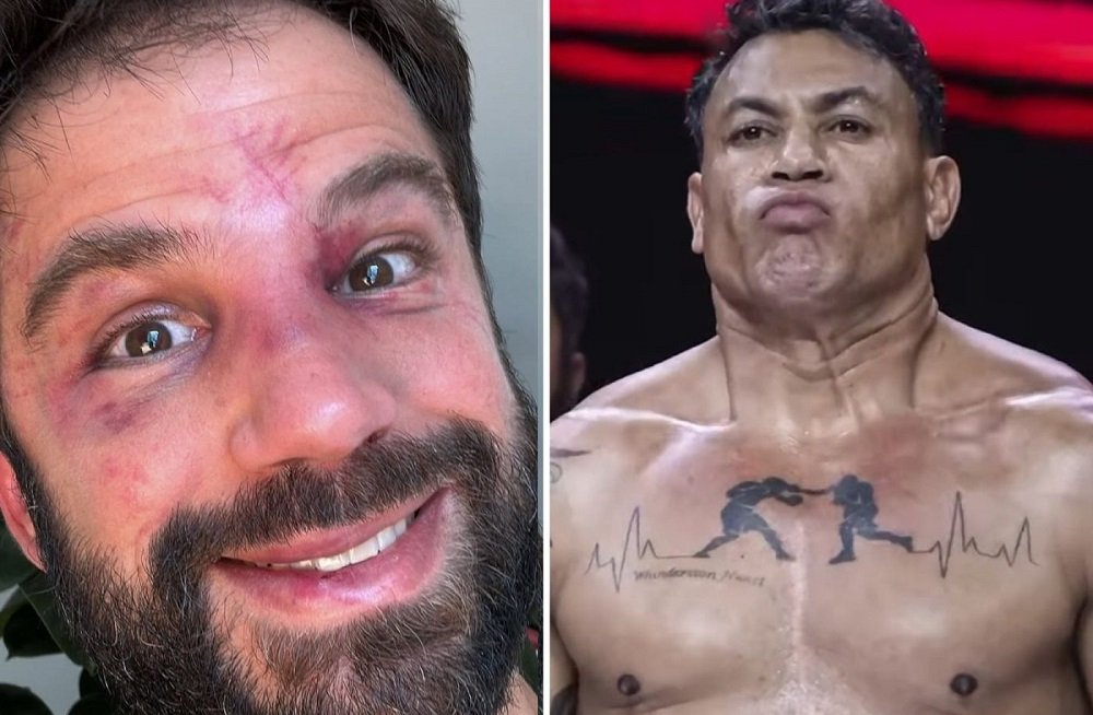 Após Luta com Popó, Duda Nagle é Barrado em Academia: “Nem a Catraca Me Reconhece!”