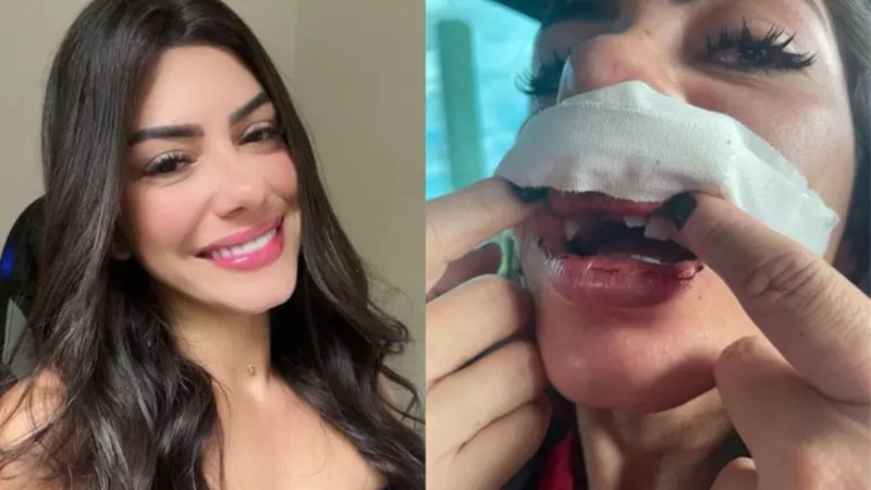 Mulher Retira Queixa Contra Cantor Após Agressão Brutal: Caso Ganha Repercussão Nacional