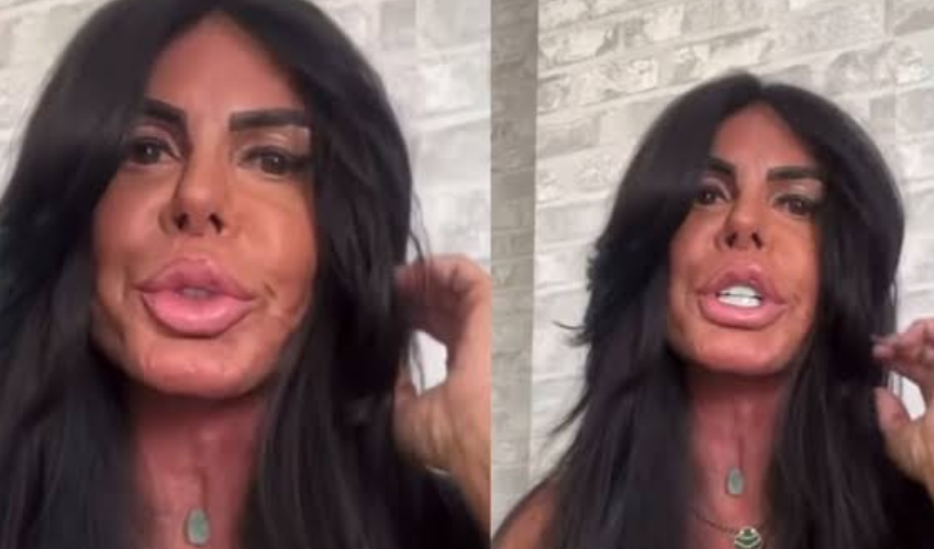 Gretchen Surpreende aos 66: Nova Harmonização Facial Sem Filtro