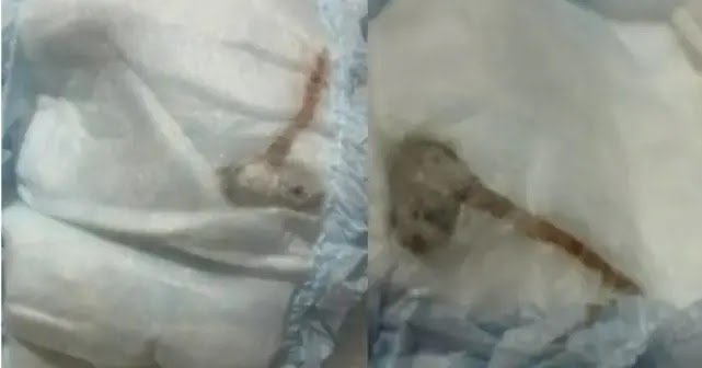 Mãe Encontra Rato Morto Dentro de Fralda de Recém-Nascido