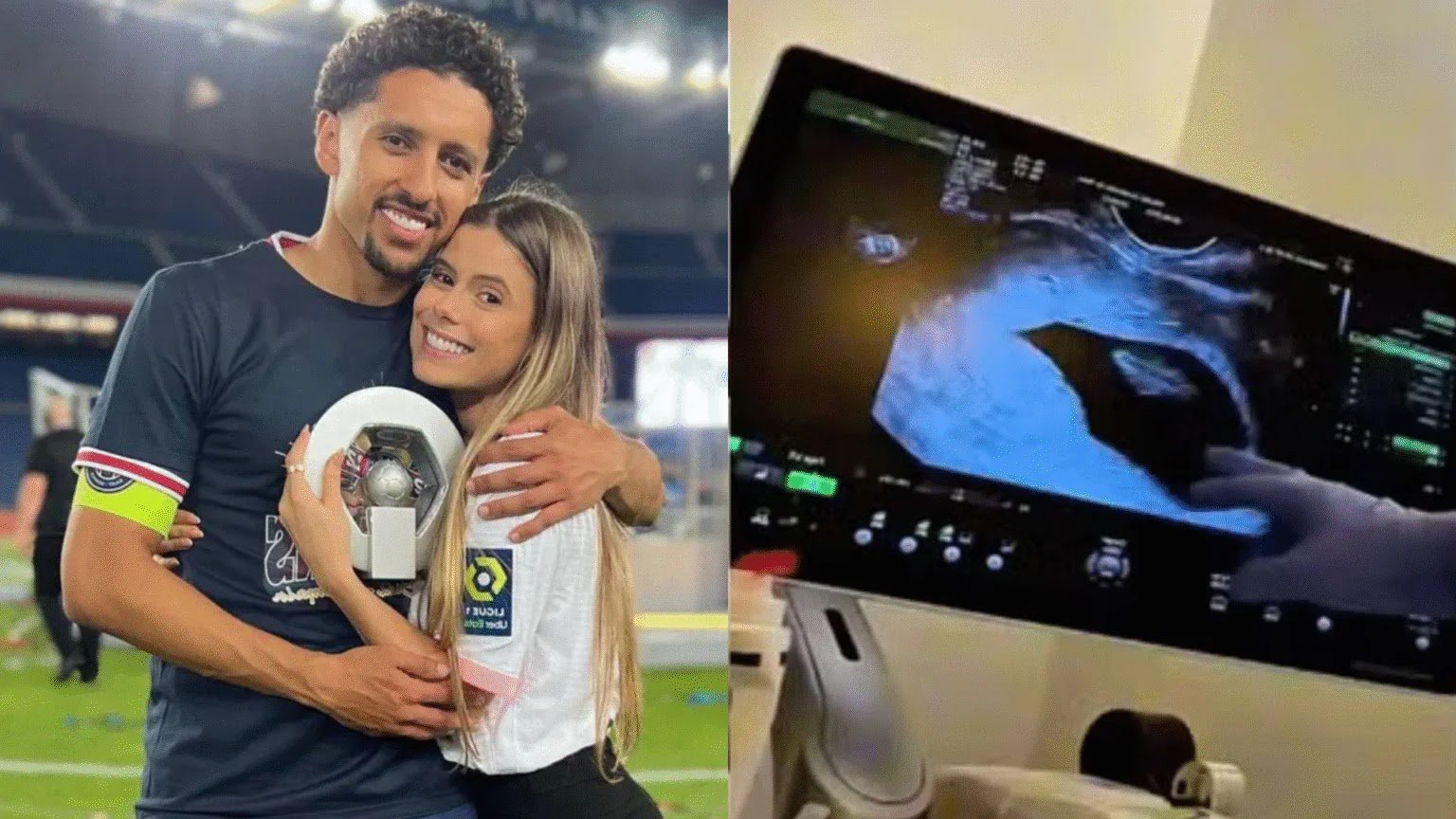 Carol Cabrino Surpreende Ao Revelar Gravidez Relâmpago Após Aborto Espontâneo