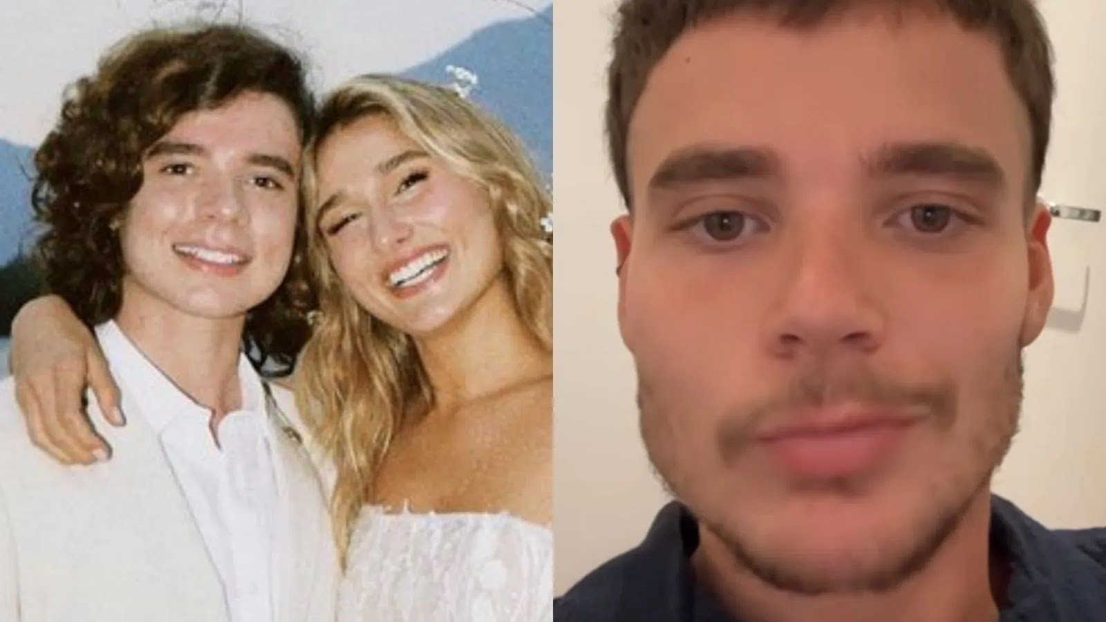 João Lucas, Marido De Sasha, Revela Procedimentos Estéticos Que Mudaram Sua Aparência