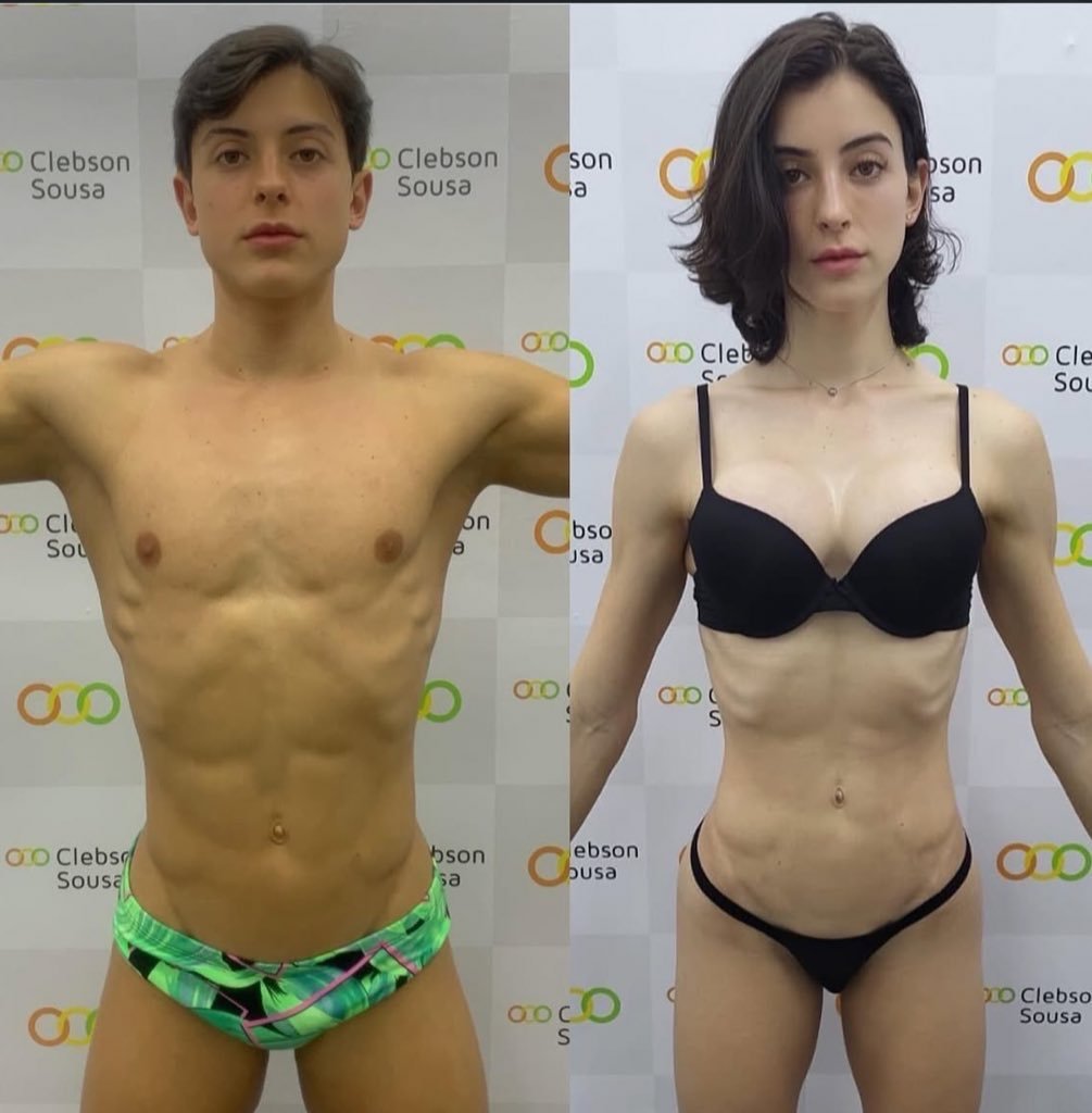 Bella Longuinho Posta Antes E Depois Da Sua Transição