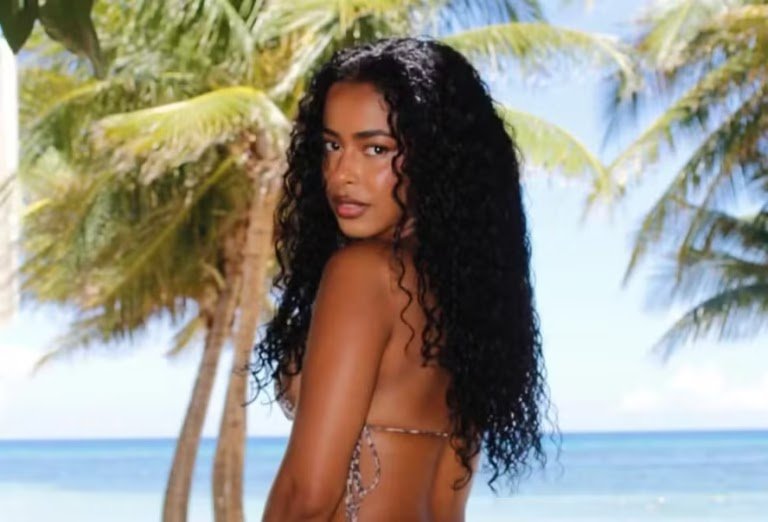 “Dendê”: Lorena Maria Revela Resultado Impressionante De Cirurgias Estéticas