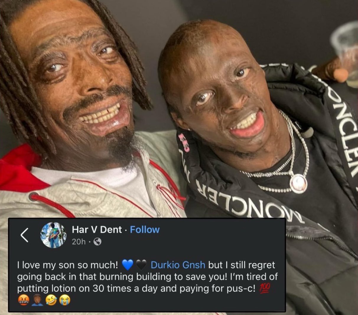 Dad's Emotional Fire Rescue Reflection Goes Viral: "I Saved My Son's Life!"