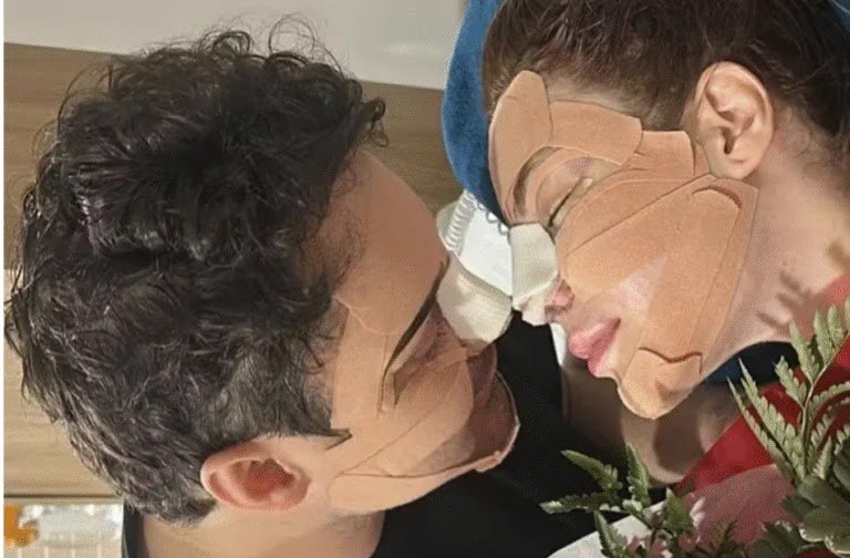 Fernando Zor E Namorada Mostram Resultados Das Rinoplastias: “Experiência Única”