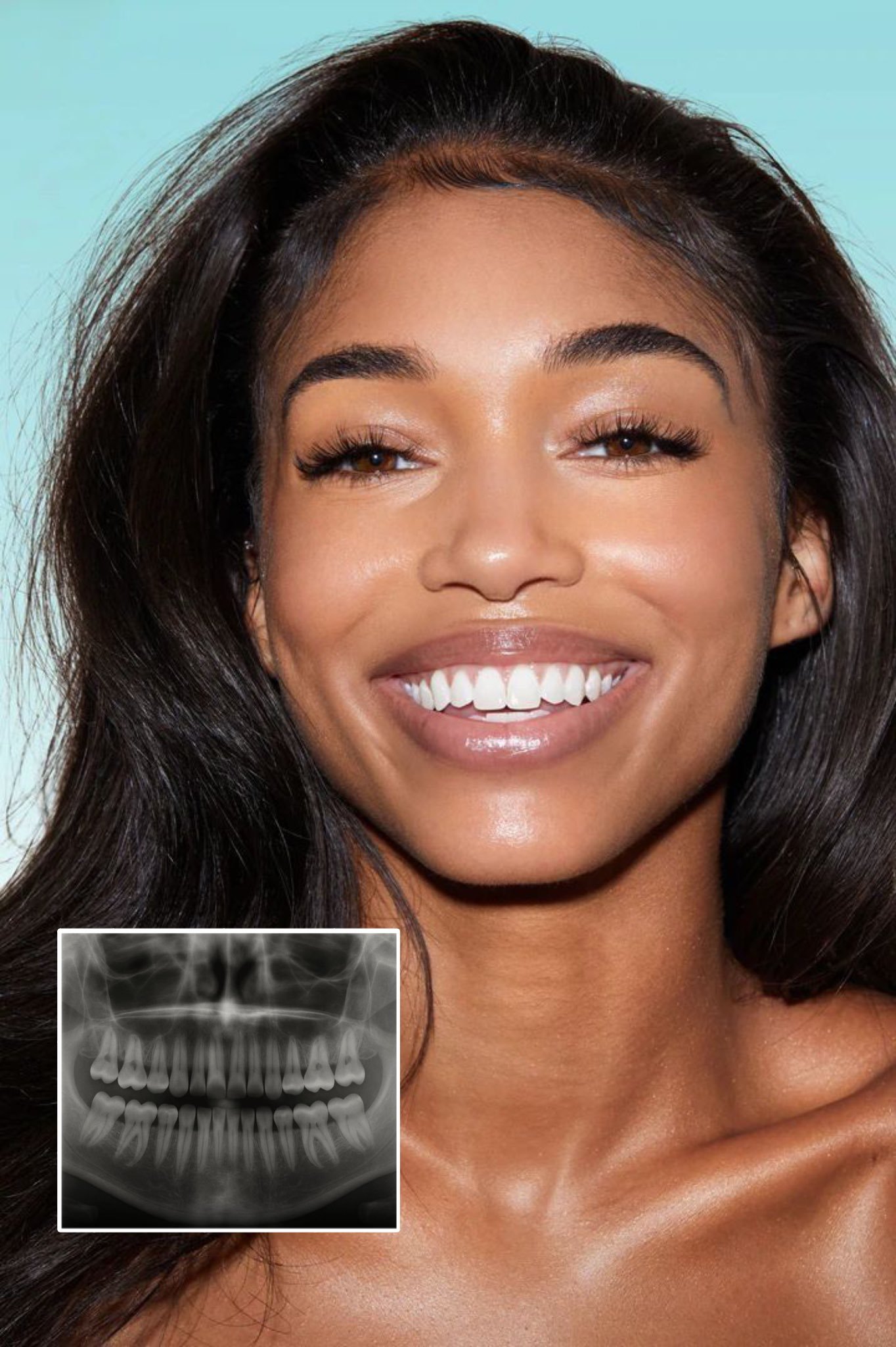 Humans May Soon Regrow Lost Teeth Naturally!