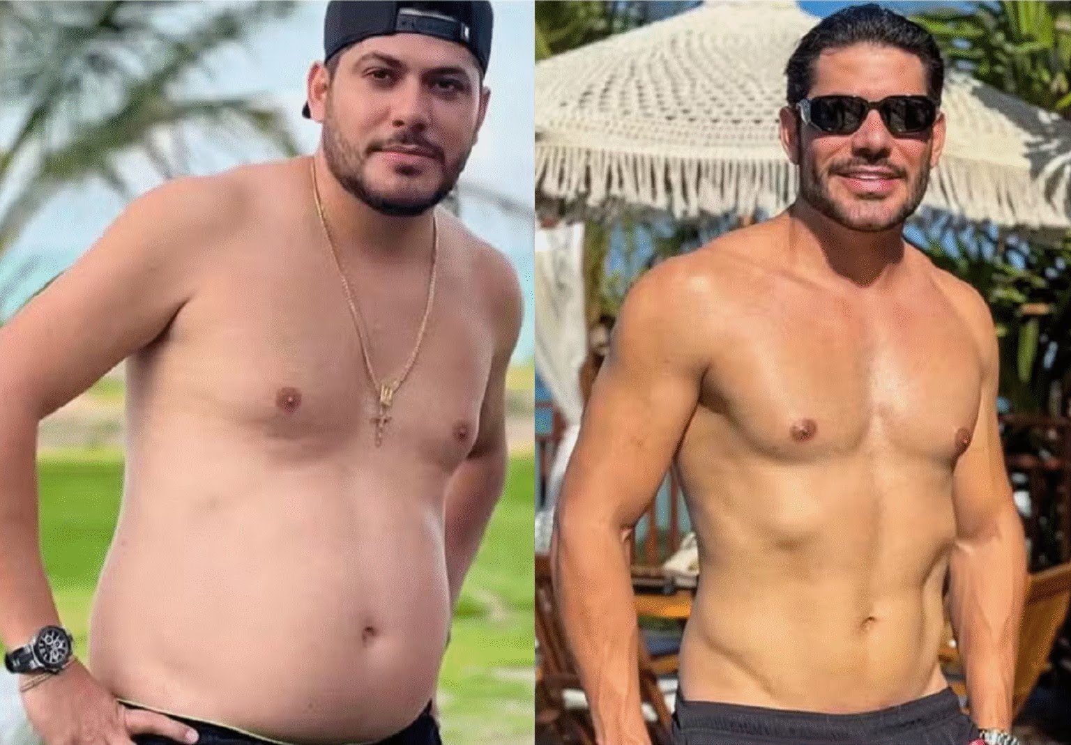 Inacreditável: Ex De Marília Mendonça, Yugnir Ângelo Mostra Antes E Depois Chocante