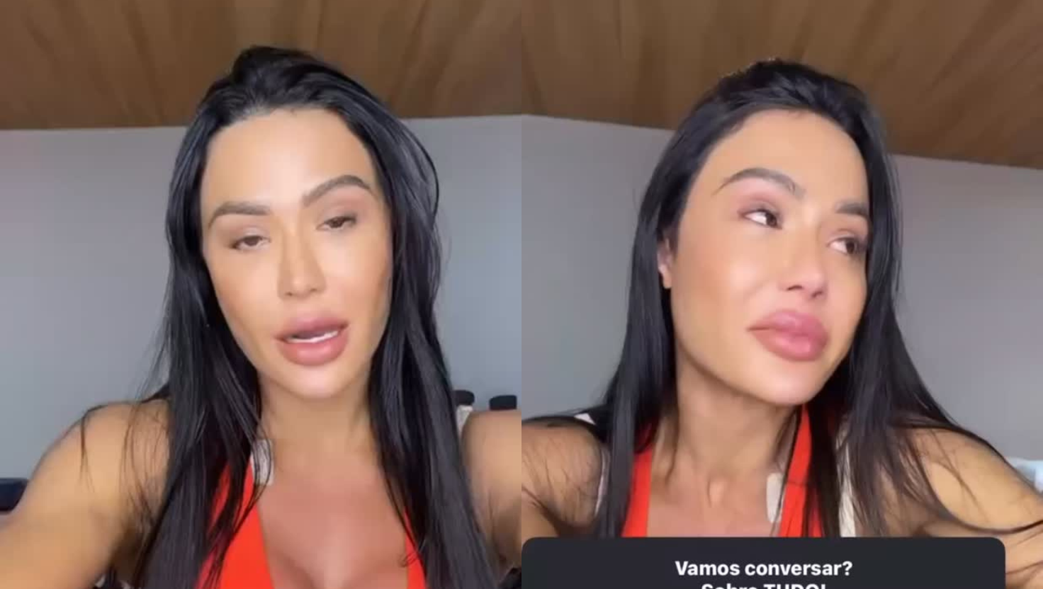 Gracyanne Barbosa Se Emociona Ao Falar De Cirurgia Após Lesão: “Muita Dor”