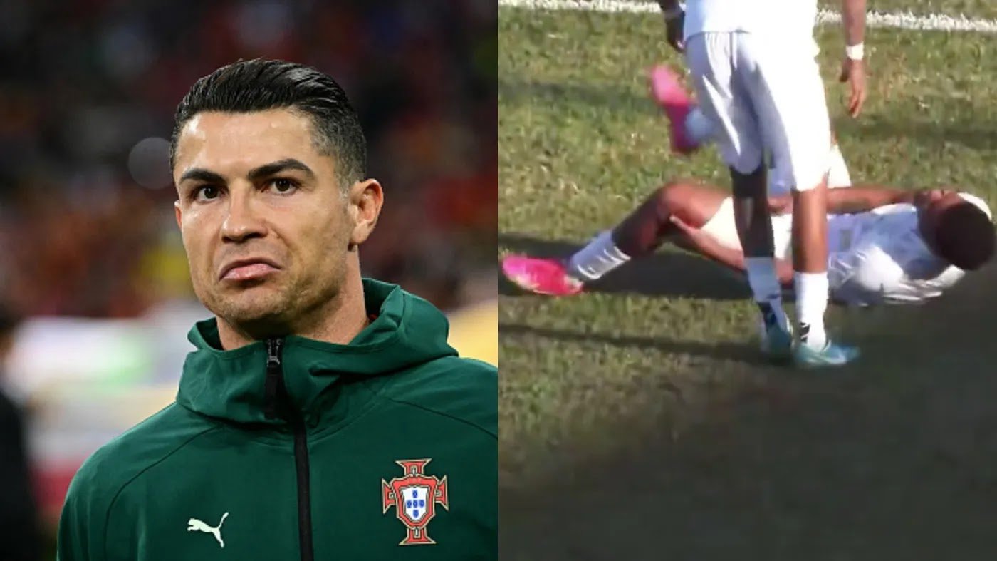 Guy Injured Himself Doing Ronaldo’s Celebration