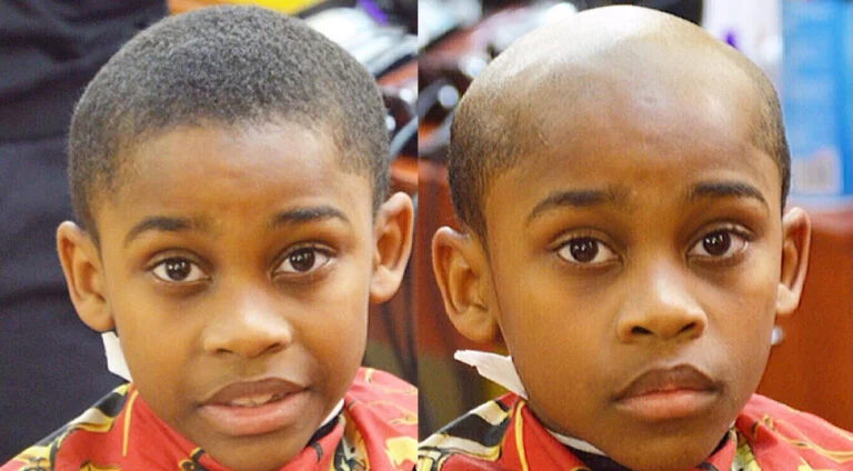 Father Gives Son Patchy Haircut as School Discipline